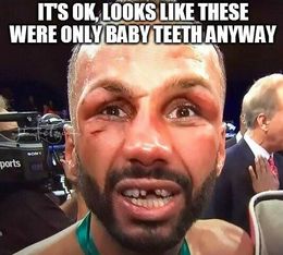 James degale lost his front teeth memes