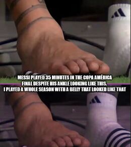 Ankle memes